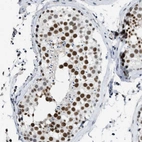 Immunohistochemical staining of human testis shows high expression.