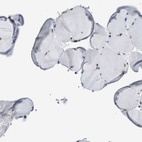 Immunohistochemical staining of human skeletal muscle shows low expression as expected.