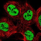 Immunofluorescent staining of human cell line A-431 shows localization to nucleoplasm.