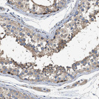 Anti-DHX58 Antibody