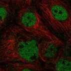 Immunofluorescent staining of human cell line A-431 shows localization to nucleoplasm.