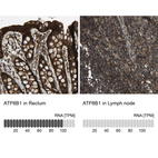 Anti-ATP8B1 Antibody