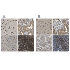 Immunohistochemical staining of human cerebral cortex, kidney, liver and lymph node using Anti-ATP8B1 antibody HPA018673 (A) shows similar protein distribution across tissues to independent antibody HPA018674 (B).