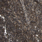 Immunohistochemical staining of human lymph node shows low expression as expected.