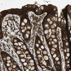 Immunohistochemical staining of human rectum shows high expression.