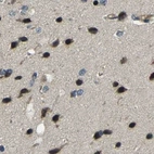 Immunohistochemical staining of human cerebral cortex using Anti-ATP8B1 antibody HPA018673.