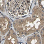 Immunohistochemical staining of human kidney using Anti-ATP8B1 antibody HPA018673.