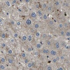 Anti-ATP8B1 Antibody