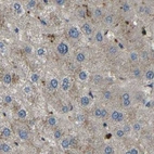 Immunohistochemical staining of human liver using Anti-ATP8B1 antibody HPA018673.
