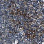 Immunohistochemical staining of human lymph node using Anti-ATP8B1 antibody HPA018674.