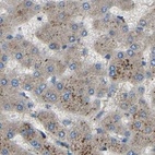 Anti-ATP8B1 Antibody