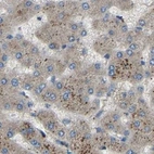 Immunohistochemical staining of human liver using Anti-ATP8B1 antibody HPA018674.