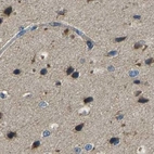 Immunohistochemical staining of human cerebral cortex using Anti-ATP8B1 antibody HPA018674.