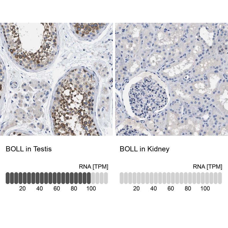 Anti-BOLL Antibody