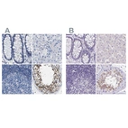 Immunohistochemical staining of human colon, liver, lymph node and testis using Anti-BOLL antibody HPA018678 (A) shows similar protein distribution across tissues to independent antibody HPA048813 (B).
