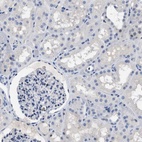 Immunohistochemical staining of human kidney shows low expression as expected.