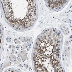 Immunohistochemical staining of human testis shows high expression.