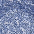 Immunohistochemical staining of human lymph node using Anti-BOLL antibody HPA018678.