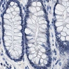 Immunohistochemical staining of human colon using Anti-BOLL antibody HPA018678.