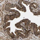 Immunohistochemical staining of human prostate shows strong granular cytoplasmic positivity in glandular cells.