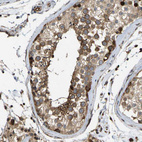 Immunohistochemical staining of human testis shows strong granular cytoplasmic positivity in cells in seminiferous ducts.