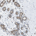 Anti-MRPS30 Antibody