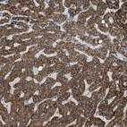 Immunohistochemical staining of human liver shows strong granular cytoplasmic positivity in hepatocytes.