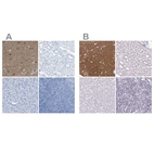 Immunohistochemical staining of human cerebral cortex, kidney, liver and lymph node using Anti-FAIM2 antibody HPA018790 (A) shows similar protein distribution across tissues to independent antibody HPA048800 (B).