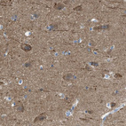 Immunohistochemical staining of human cerebral cortex shows moderate granular cytoplasmic positivity in neurons.