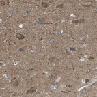 Immunohistochemical staining of human cerebral cortex shows moderate granular cytoplasmic positivity in neurons.