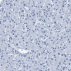 Immunohistochemical staining of human liver shows no positivity in hepatocytes as expected.