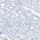 Immunohistochemical staining of human kidney shows no positivity in cells in tubules as expected.
