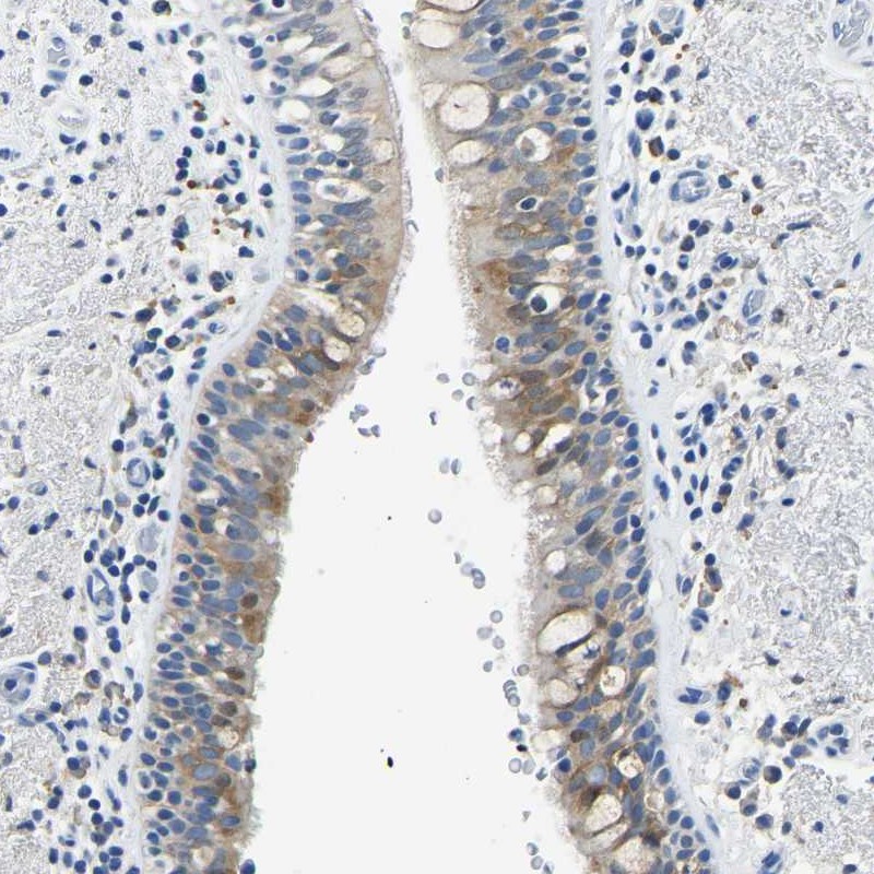 Anti-ZDHHC13 Antibody