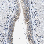 Anti-ZDHHC13 Antibody