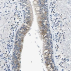 Anti-ZDHHC13 Antibody
