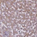 Anti-ST3GAL6 Antibody