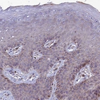 Immunohistochemical staining of human skin shows weak to moderate cytoplasmic positivity in squamous epithelial cells.