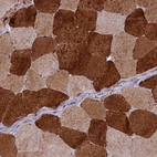 Immunohistochemical staining of human skeletal muscle shows moderate to strong cytoplasmic positivity in myocytes.