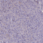 Anti-ST3GAL6 Antibody