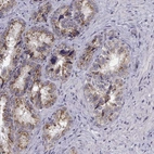 Immunohistochemical staining of human seminal vesicle shows high expression.