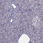 Immunohistochemical staining of human pancreas shows low expression as expected.
