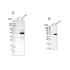 Western blot analysis using Anti-PDLIM7 antibody HPA018794 (A) shows similar pattern to independent antibody HPA048815 (B).