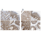 Anti-GCN1 Antibody