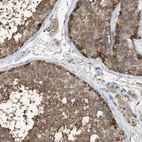Immunohistochemical staining of human testis shows strong cytoplasmic positivity in cells in seminiferous ducts.