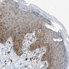 Immunohistochemical staining of human skin shows strong cytoplasmic positivity in squamous epithelial cells.