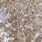 Immunohistochemical staining of human stomach shows strong cytoplasmic positivity in glandular cells.