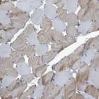 Immunohistochemical staining of human skeletal muscle shows moderate cytoplasmic positivity in myocytes.