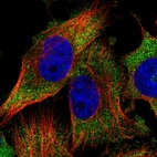 Immunofluorescent staining of human cell line U-251 MG shows localization to cytosol.