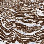 Immunohistochemical staining of human heart muscle shows moderate to strong cytoplasmic and membranous positivity in cardiomyocytes.