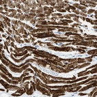 Immunohistochemical staining of human heart muscle shows moderate to strong cytoplasmic and membranous positivity in cardiomyocytes.